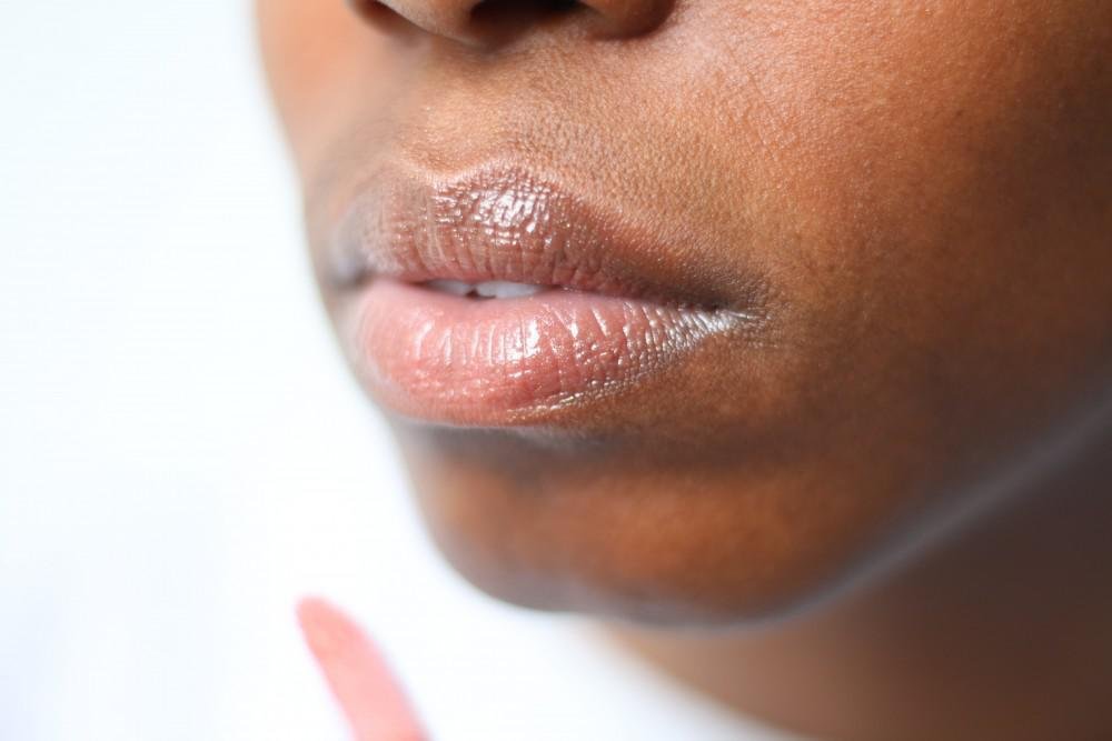 The Five W’s of of Chapped Lips