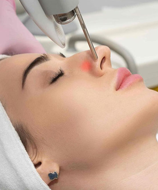 Light & Laser Treatments